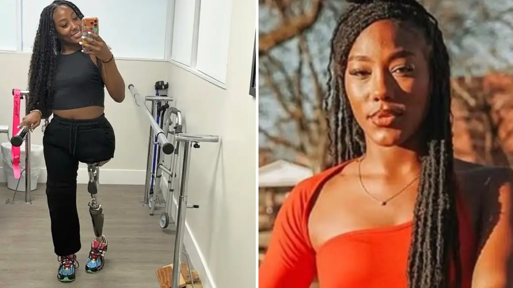 Hannah, 22, förlorade
båda benen på drömresan