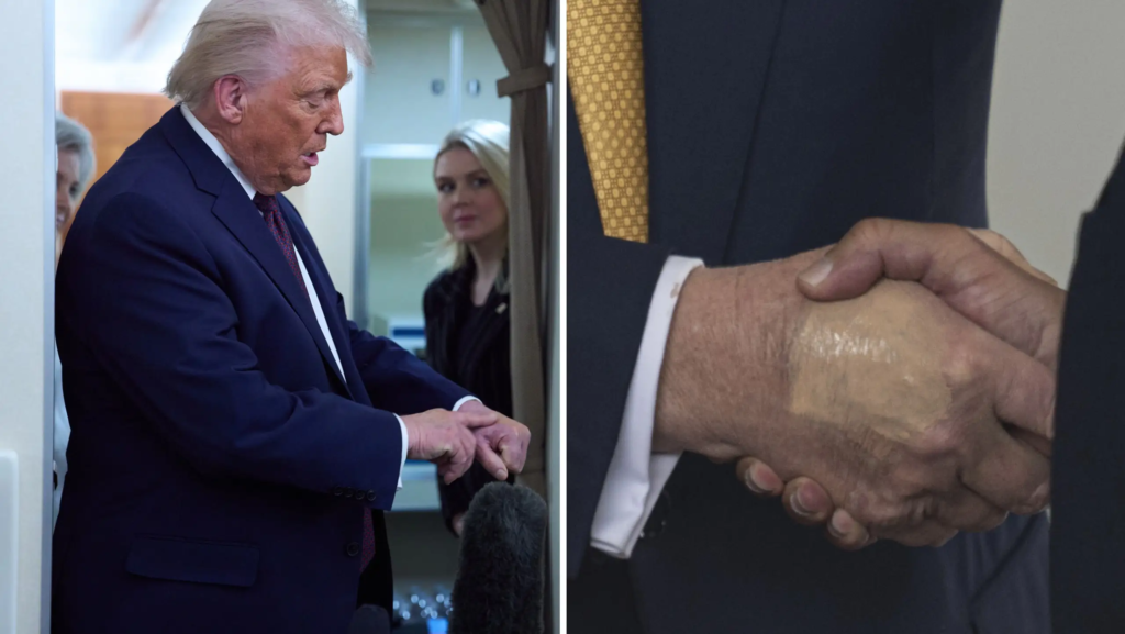 Ingen ny info om Trumps hälsa
– läkares skarpa kritik